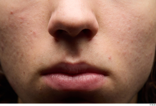 HD Face Skin Bryton cheek face lips mouth nose skin…